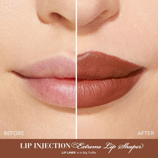 Lip Injection L�pis Boca In Big Truffle